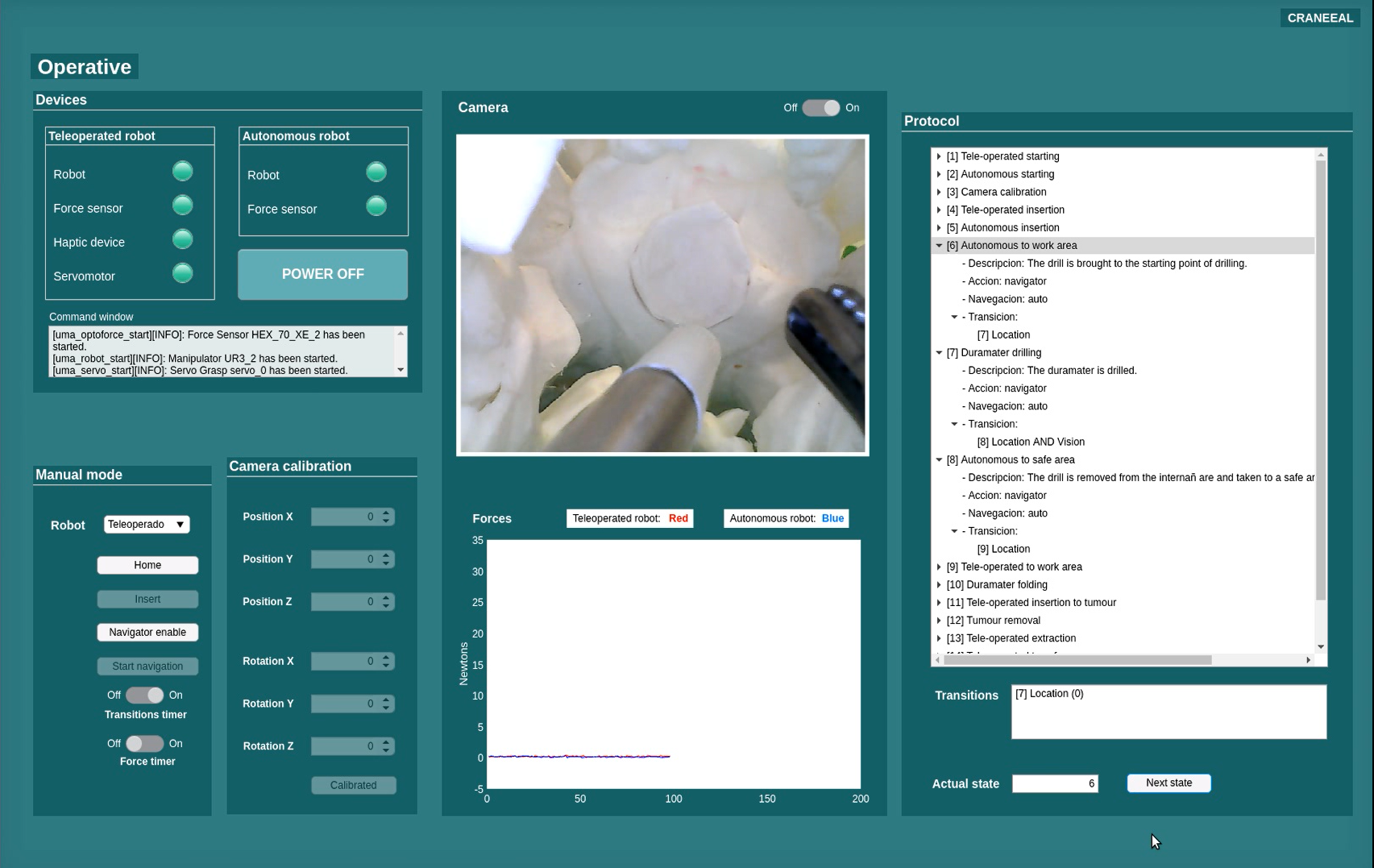 Craneeal interface
